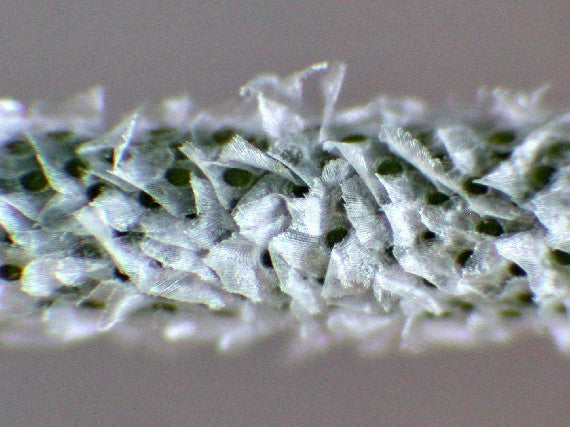 Microscopic photograph of trichomes on a tillandsia air plant 